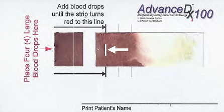 Toma de muestra de sangre  - test de ADN prenatal