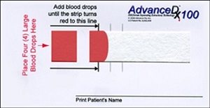 Toma de muestra de sangre  - test de ADN prenatal