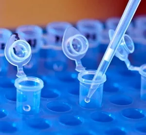 Estudio de ADN entre primos - Laboratorio ADN