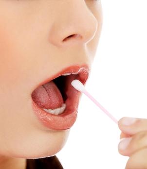 ¿El hisopo bucal produce resultados tan precisos como los generados utilizando muestras de sangre?